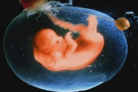 梦见堕胎 打胎